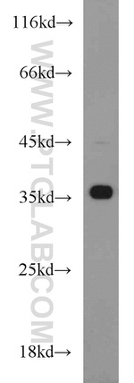 HOXD13 Antibody in Western Blot (WB)