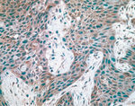 c-Met Antibody in Immunohistochemistry (IHC)