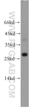 TPPP Antibody in Western Blot (WB)