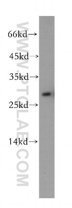 TPPP Antibody in Western Blot (WB)