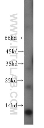 TPPP Antibody in Western Blot (WB)