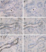 ZO-1 Antibody in Immunohistochemistry (IHC)