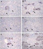 ZO-1 Antibody in Immunohistochemistry (IHC)