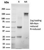 E2F6 Antibody in SDS-PAGE (SDS-PAGE)