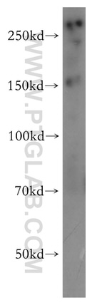 NIPBL Antibody in Western Blot (WB)