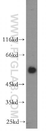 HSF4 Antibody in Western Blot (WB)