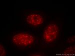 PSME4 Antibody in Immunocytochemistry (ICC/IF)