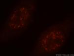 PSME4 Antibody in Immunocytochemistry (ICC/IF)