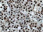 PSME4 Antibody in Immunohistochemistry (Paraffin) (IHC (P))