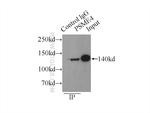 PSME4 Antibody in Immunoprecipitation (IP)