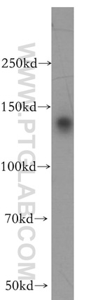 PSME4 Antibody in Western Blot (WB)