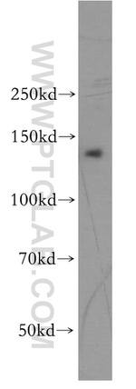 PSME4 Antibody in Western Blot (WB)