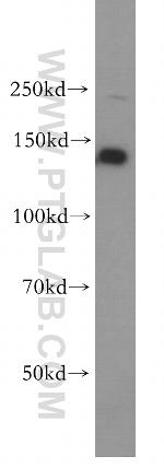 PSME4 Antibody in Western Blot (WB)