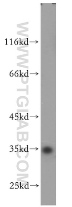 PSKH2 Antibody in Western Blot (WB)