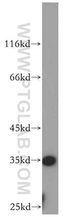 PSKH2 Antibody in Western Blot (WB)