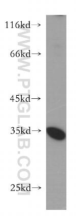 PSKH2 Antibody in Western Blot (WB)