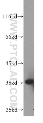 PSKH2 Antibody in Western Blot (WB)