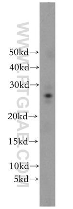 RAB41 Antibody in Western Blot (WB)