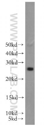 RAB41 Antibody in Western Blot (WB)