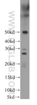 RAB41 Antibody in Western Blot (WB)