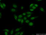 RBP2 Antibody in Immunocytochemistry (ICC/IF)