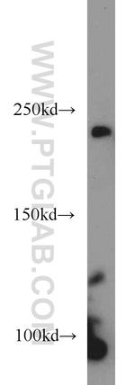 RBP2 Antibody in Western Blot (WB)