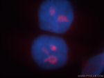 1A6/DRIM Antibody in Immunocytochemistry (ICC/IF)