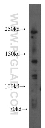 1A6/DRIM Antibody in Western Blot (WB)