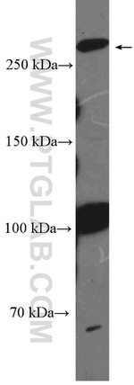 1A6/DRIM Antibody in Western Blot (WB)