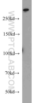 1A6/DRIM Antibody in Western Blot (WB)