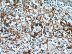 CD36 Antibody in Immunohistochemistry (Paraffin) (IHC (P))