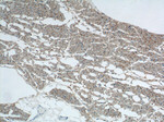 CD36 Antibody in Immunohistochemistry (Paraffin) (IHC (P))