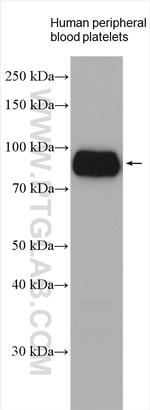 CD36 Antibody in Western Blot (WB)