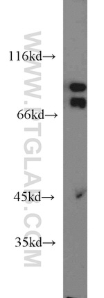 CD36 Antibody in Western Blot (WB)