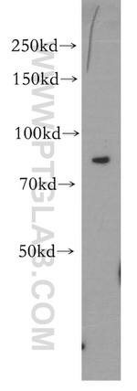 CD36 Antibody in Western Blot (WB)