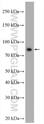 CD36 Antibody in Western Blot (WB)