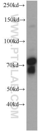 SORCS1 Antibody in Western Blot (WB)