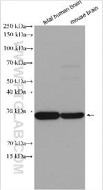 RAB12 Antibody in Western Blot (WB)