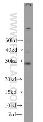 RAB12 Antibody in Western Blot (WB)