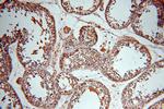 UBN2 Antibody in Immunohistochemistry (Paraffin) (IHC (P))