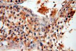 UBN2 Antibody in Immunohistochemistry (Paraffin) (IHC (P))