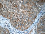 IRF2BP2 Antibody in Immunohistochemistry (Paraffin) (IHC (P))