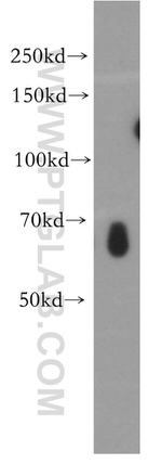 IRF2BP2 Antibody in Western Blot (WB)