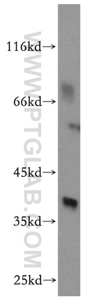 AKR1C4 Antibody in Western Blot (WB)