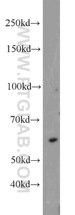 UBR2 Antibody in Western Blot (WB)