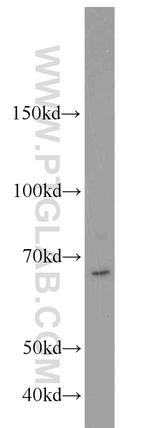 UBR2 Antibody in Western Blot (WB)