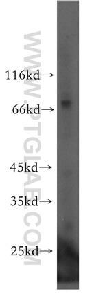UTP3 Antibody in Western Blot (WB)