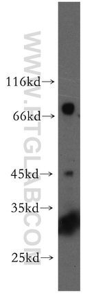 UTP3 Antibody in Western Blot (WB)