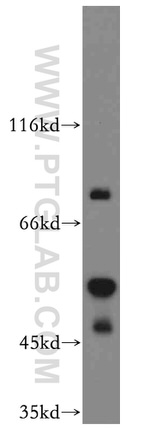 REXO4 Antibody in Western Blot (WB)