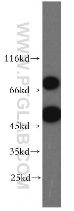 REXO4 Antibody in Western Blot (WB)